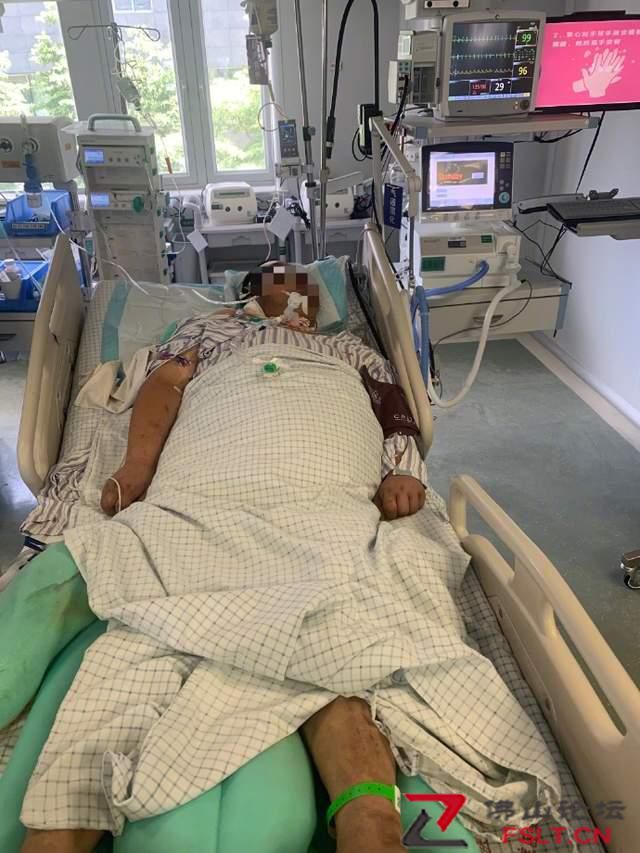 广东32岁快递员患热射病住进ICU，昏迷一个多月仍未醒